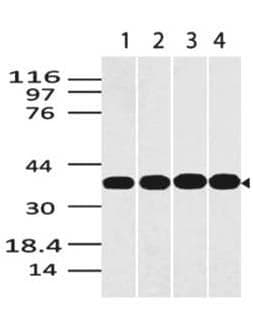 IHC-plus™ Monoclonal Mouse anti-Human GAPDH Antibody (clone ABM22C5, aa120-320, IHC, WB)