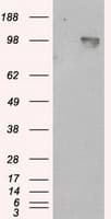 APP / Beta Amyloid Precursor Antibody (clone OTI7G9)