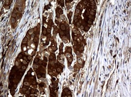 NME1 / NM23 Antibody (clone OTI1A12)