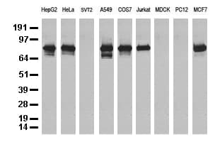 NBN / Nibrin Antibody (aa183-460, clone UMAB100, Carrier-free)