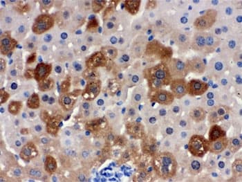 SULT2A1 / Sulfotransferase 2A1 Antibody