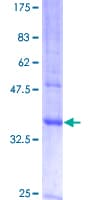 Human MAL Protein (Recombinant GST)