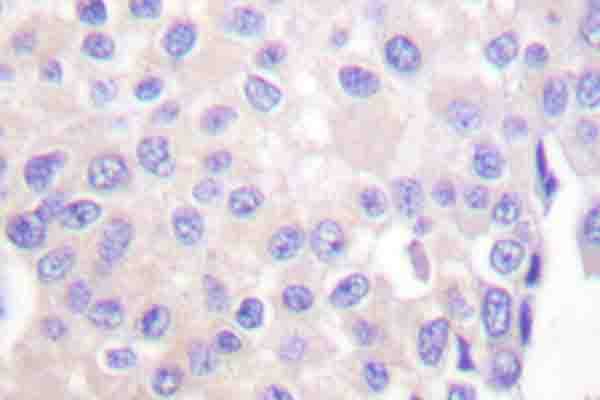 p66 / SHC Antibody (phospho-Tyr349)
