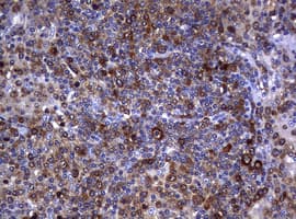 NME1 / NM23 Antibody (clone OTI7F4, Carrier-free)
