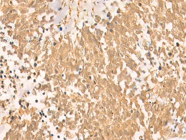 Polyclonal Rabbit anti-Human FAT10 / UBD Antibody (IHC)