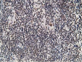 ADH2 / ADH1B Antibody (clone OTI4F12)