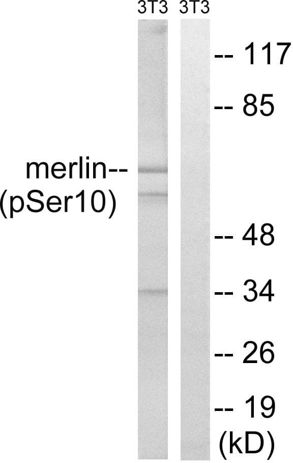 NF2 / Merlin Antibody (phospho-Ser10)