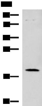 Polyclonal Rabbit anti-Human C6orf108 Antibody (IHC, WB)