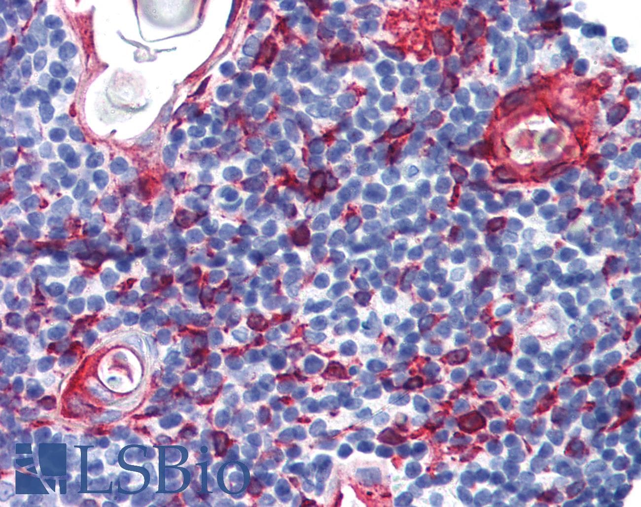 IHC-plus™ Monoclonal Mouse anti-Human KRT13 / CK13 / Cytokeratin 13 Antibody (clone AE8, IHC, WB)