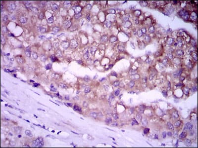 Monoclonal Mouse anti-Human GPC3 / Glypican 3 Antibody (clone 9C2, aa55-200, IHC, IF, WB)