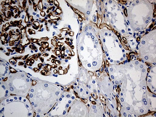 Monoclonal Mouse anti-Human CD34 Antibody (clone OTI8F11, aa312-385, IHC, WB)
