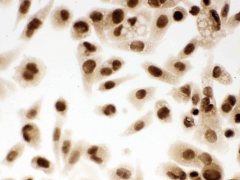 Polyclonal Rabbit anti-Human DDB1 Antibody (IHC, WB)