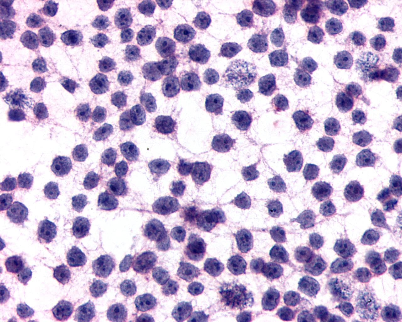 PathPlus™ ADGRE5 / CD97 Antibody (N-Terminus)