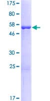 Human ANP32B Protein (Recombinant GST)