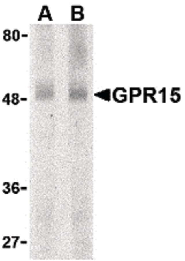 BOB / GPR15 Antibody