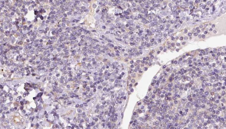 STX16 / Syntaxin 16 Antibody