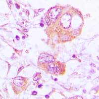 Polyclonal Rabbit anti-Human CTSH / Cathepsin H Antibody (Internal, IHC, WB)