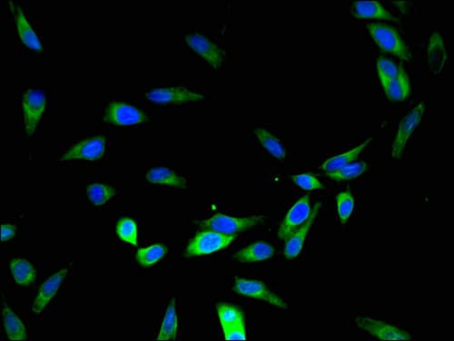 Polyclonal Rabbit anti-Human DYX1C1 Antibody (IHC, IF, WB)
