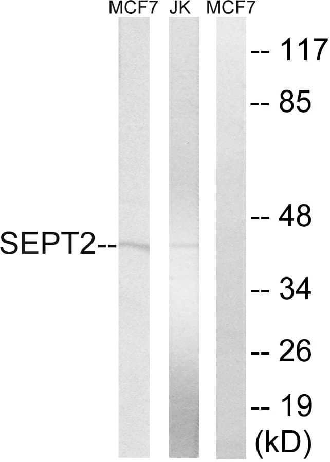 Polyclonal Rabbit anti-Human SEPT2 / Septin 2 Antibody (aa103-152, WB)