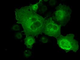 CTAG1B / NY-ESO-1 Antibody (clone OTI2B6)
