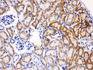 AK2 / Adenylate Kinase 2 Antibody