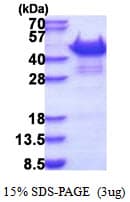 Human SORBS3 / Vinexin Protein (Recombinant His)