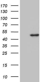 DDB2 Antibody (aa1-250, clone OTI2E12)