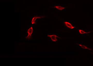 Polyclonal Rabbit anti-Human TP53I3 / PIG3 Antibody (IHC, IF, WB)