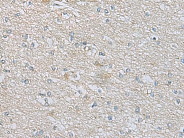 CDH12 / Cadherin 12 Antibody