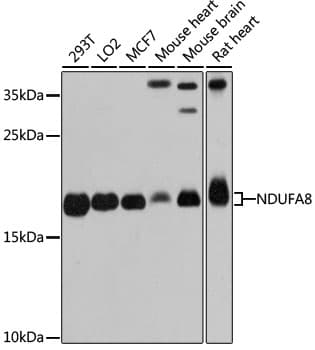 Polyclonal Rabbit anti-Human NDUFA8 Antibody (WB)