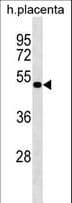 Polyclonal Rabbit anti-Human LHX8 Antibody (aa205-232, WB)