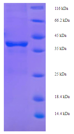 E. coli tetR Protein (Recombinant His-SUMO)