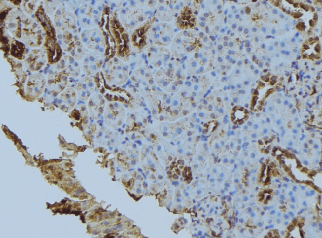 STX6 / Syntaxin 6 Antibody