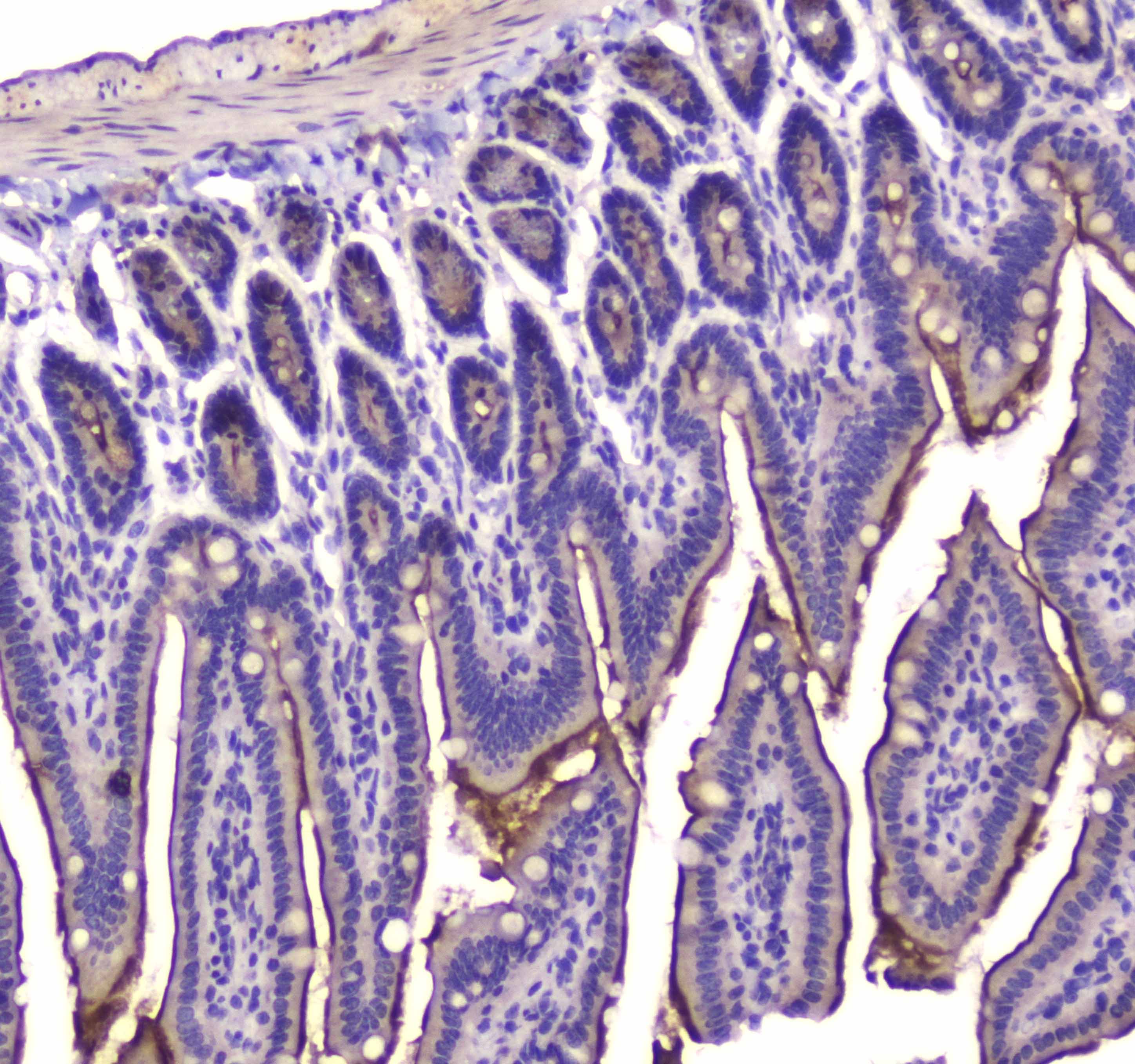 Polyclonal Rabbit anti-Human CNR1 / CB1 Antibody (IHC, WB)