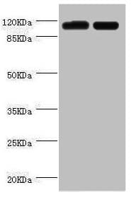 PITRM1 / MP1 Antibody