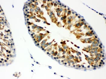 Polyclonal Rabbit anti-Human COPS5 / JAB1 Antibody (IHC, WB)
