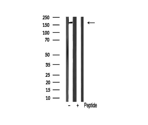 MRC2 / Endo180 Antibody