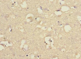 CHRNA6 Antibody
