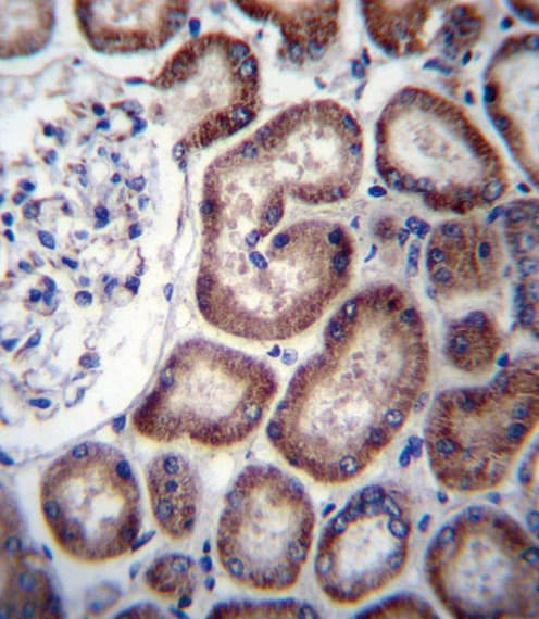 Polyclonal Rabbit anti-Human IREB2 / IRP2 Antibody (aa201-230, IHC, WB)