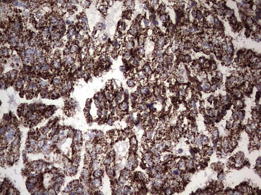 PIK3CD / PI3K Delta Antibody (aa286-610, clone OTI1D11)