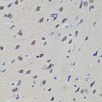 SET / TAF-I Antibody