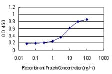 IHC-plus™ SDSL / Serine Dehydratase-Like Antibody (clone M2)
