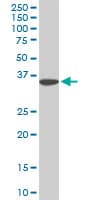 SLIM / FHL1 Antibody (clone 2A9)