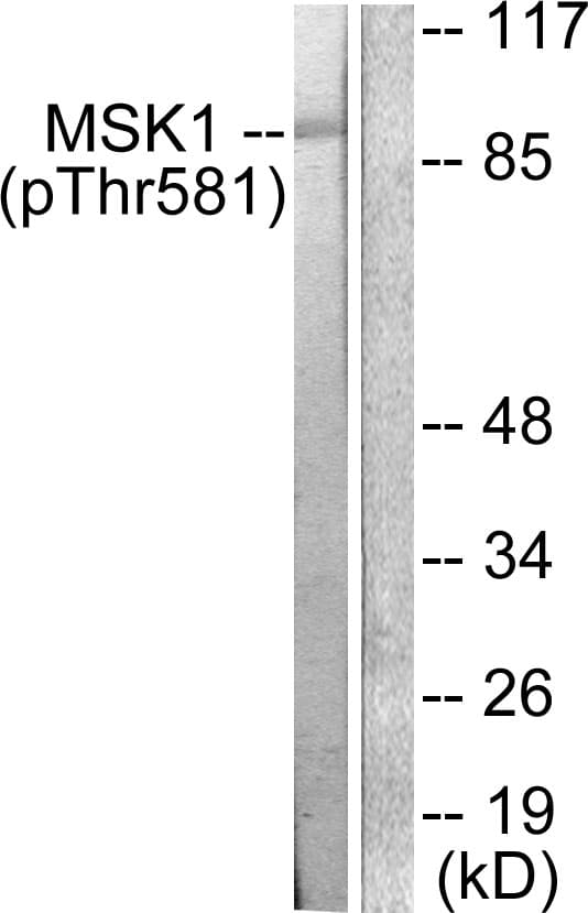 RPS6KA5 / MSK1 Antibody (phospho-Thr581)