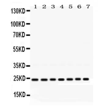 RALA / RAL Antibody (aa165-203)