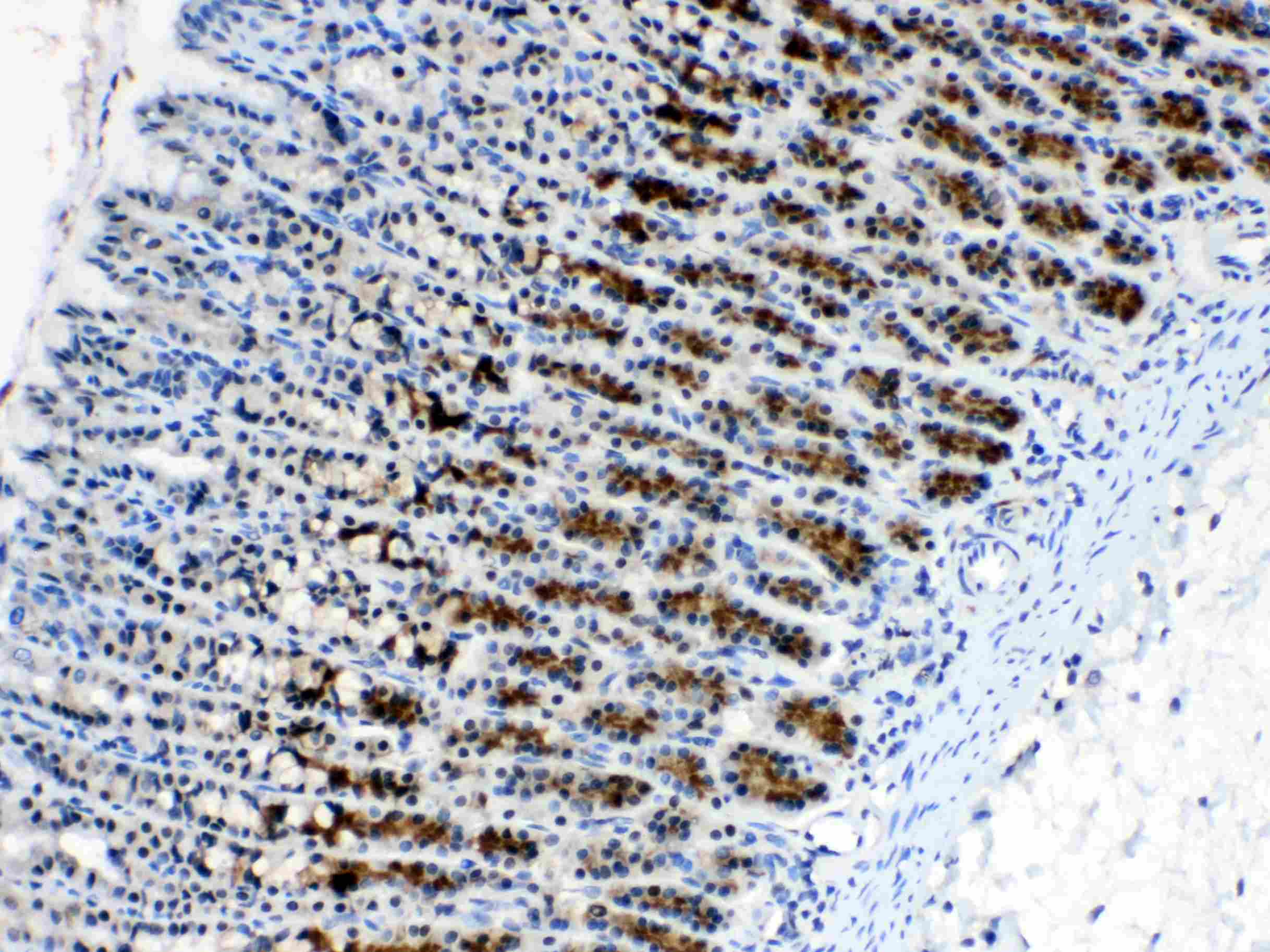 ALCAM / CD166 Antibody