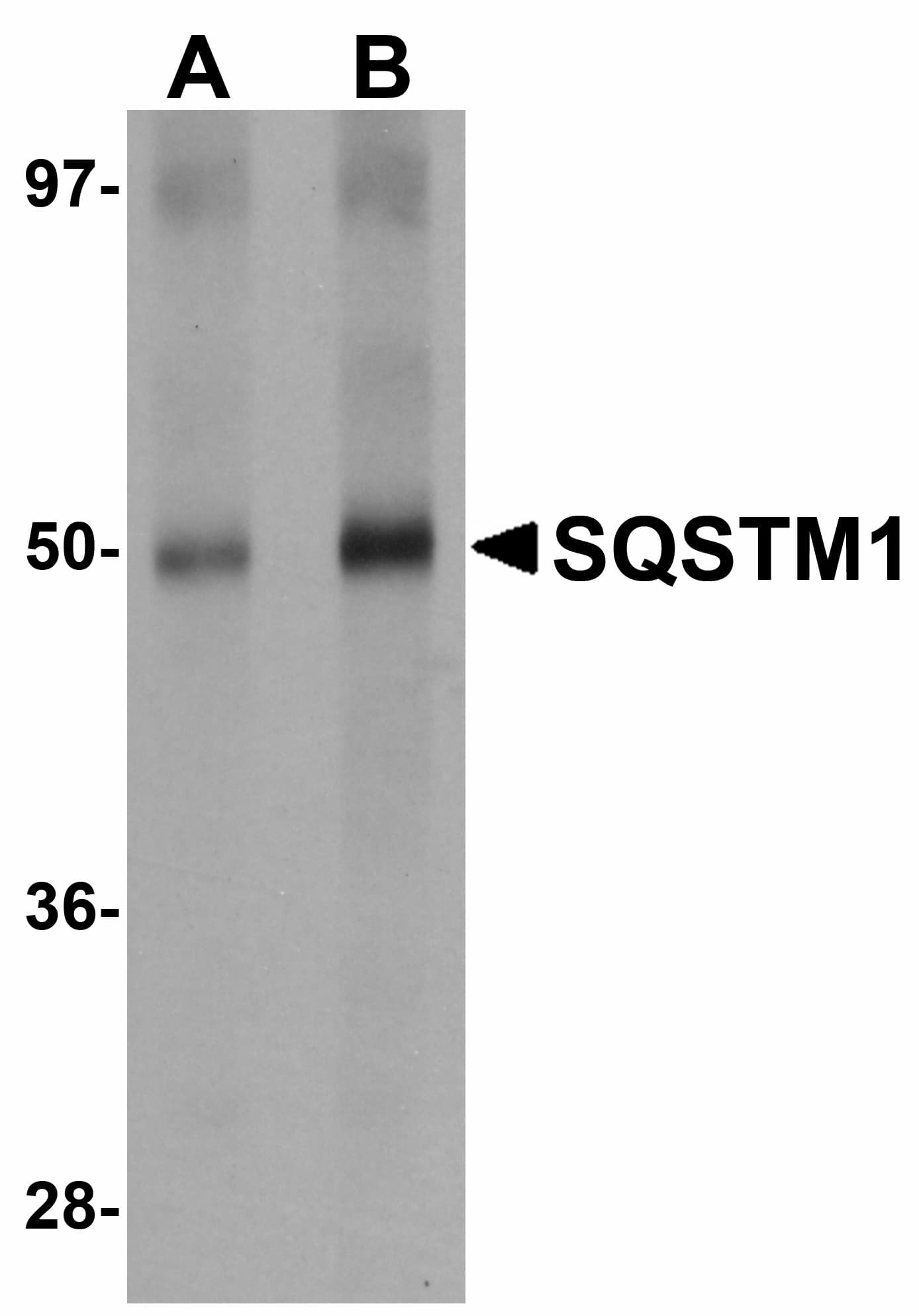 SQSTM1 Antibody