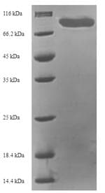 Human MAPKAP1 / MIP1 Protein (Recombinant 6His-SUMO, N-terminus)