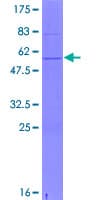 Human CSN3 / Kappa Casein Protein (Recombinant GST)