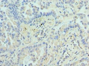 EZH1 / ENX-2 Antibody (aa160-280)